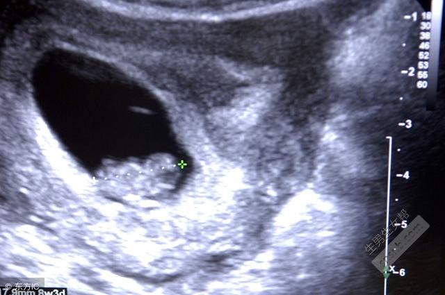  试管胚胎的自白：我就是这样出生的！